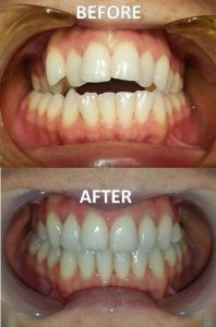 ORTHODONTIC-ASSESSMENT---Before-After